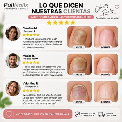PuliNails™ - Pulidora de Uñas 4 en 1